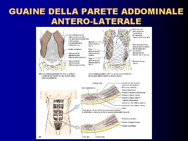 GUAINE DELLA PARETE ADDOMINALE ANTERO-LATERALE 