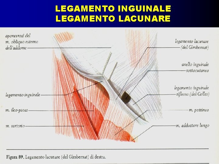 LEGAMENTO INGUINALE LEGAMENTO LACUNARE 