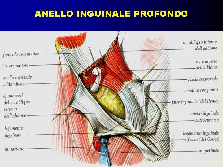 ANELLO INGUINALE PROFONDO 