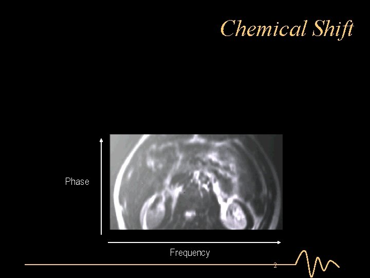 Chemical Shift Phase Frequency 2 
