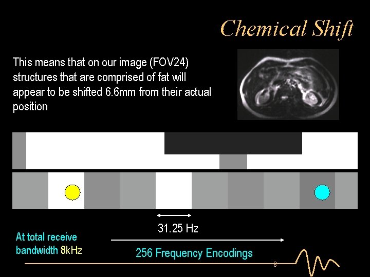 Chemical Shift This means that on our image (FOV 24) structures that are comprised