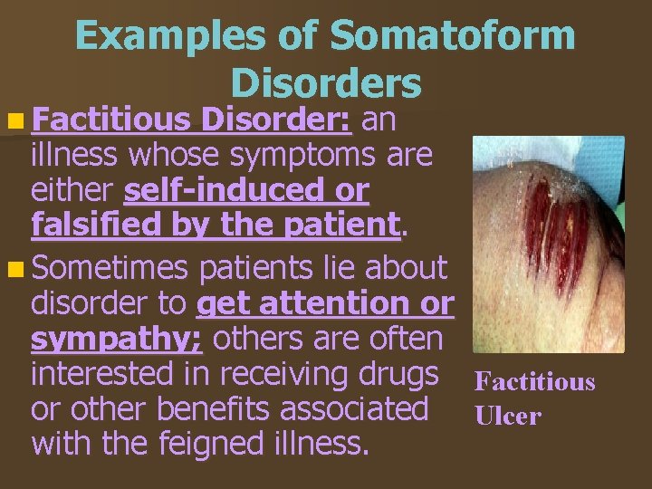 Examples of Somatoform Disorders n Factitious Disorder: an illness whose symptoms are either self-induced