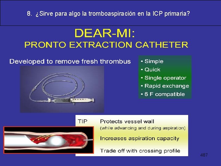 8. ¿Sirve para algo la tromboaspiración en la ICP primaria? 487 