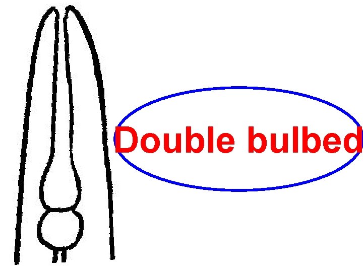 Double bulbed 