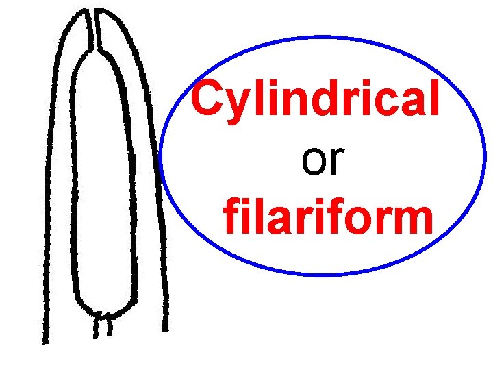 Cylindrical or filariform 