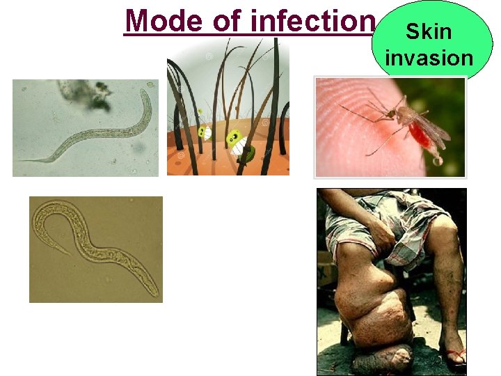 Mode of infection Skin invasion 