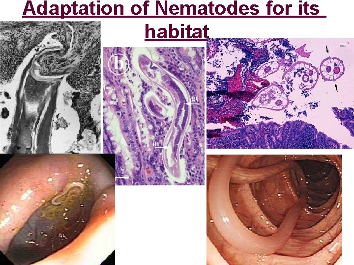 Adaptation of Nematodes for its habitat 