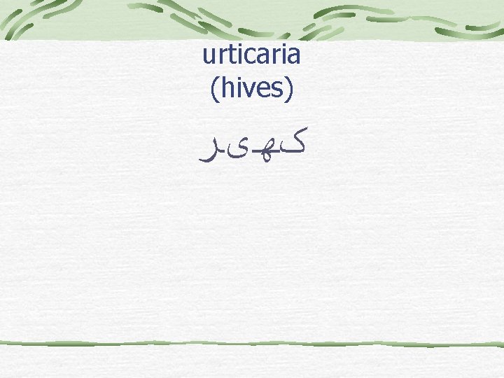 urticaria (hives) کﻬیﺮ 