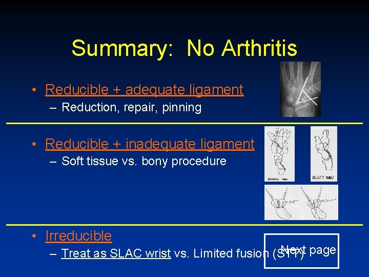 Summary: No Arthritis • Reducible + adequate ligament – Reduction, repair, pinning • Reducible