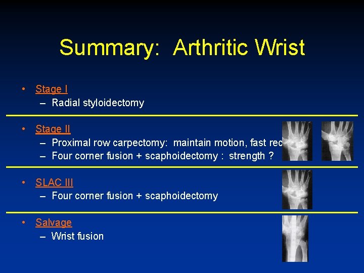 Summary: Arthritic Wrist • Stage I – Radial styloidectomy • Stage II – Proximal
