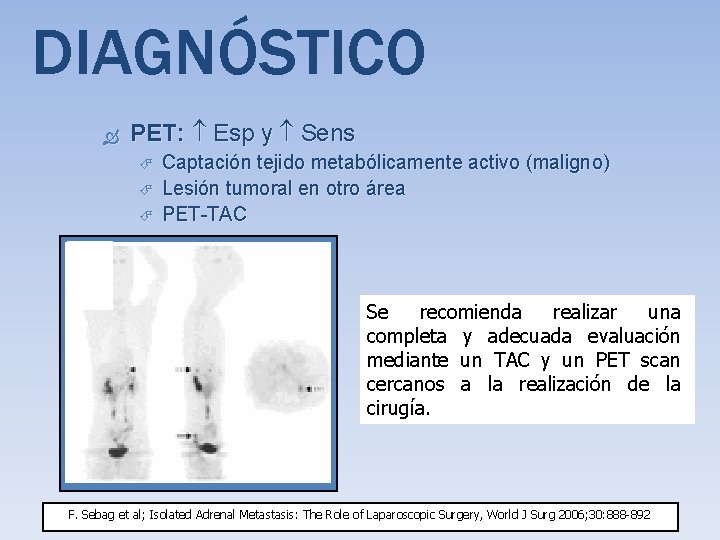 DIAGNÓSTICO PET: Esp y Sens Captación tejido metabólicamente activo (maligno) Lesión tumoral en otro