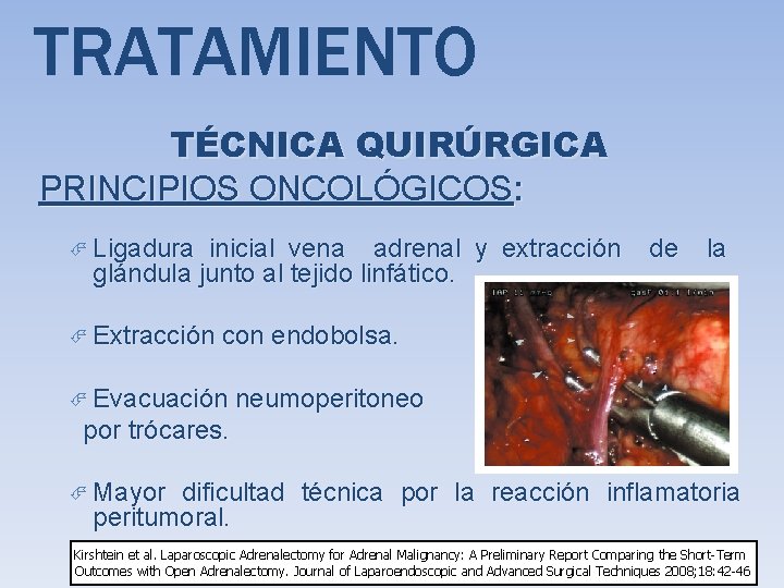 TRATAMIENTO TÉCNICA QUIRÚRGICA PRINCIPIOS ONCOLÓGICOS: Ligadura inicial vena adrenal y extracción glándula junto al