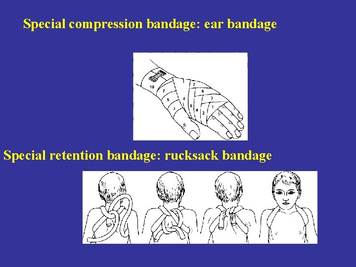 Special compression bandage: ear bandage Special retention bandage: rucksack bandage 