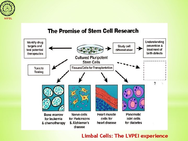 MIFBL Limbal Cells: The LVPEI experience 