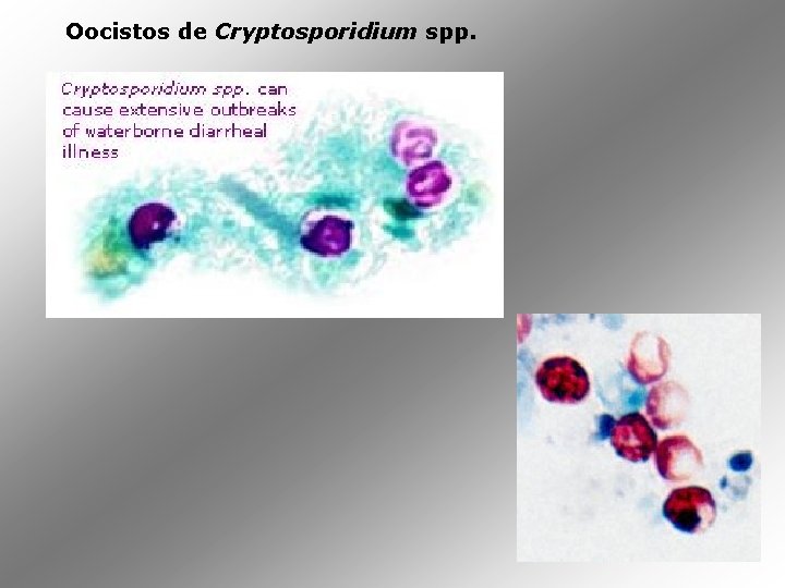 Oocistos de Cryptosporidium spp. 