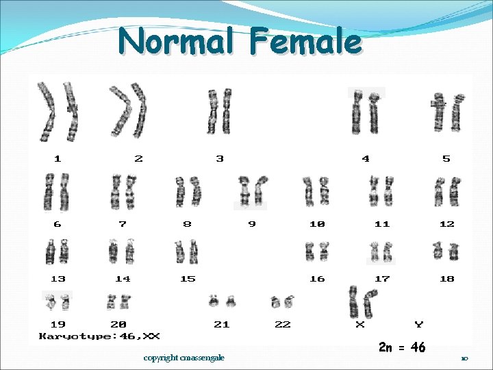 Normal Female copyright cmassengale 2 n = 46 10 