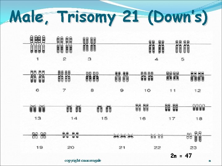 Male, Trisomy 21 (Down’s) copyright cmassengale 2 n = 47 11 