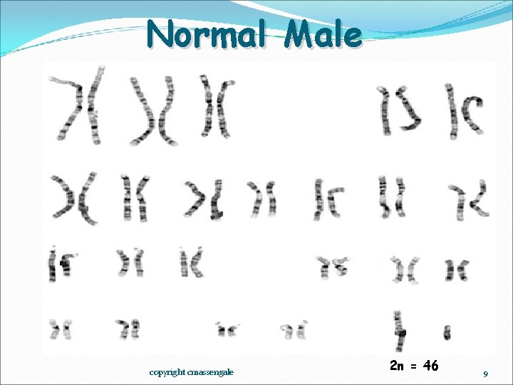 Normal Male copyright cmassengale 2 n = 46 9 