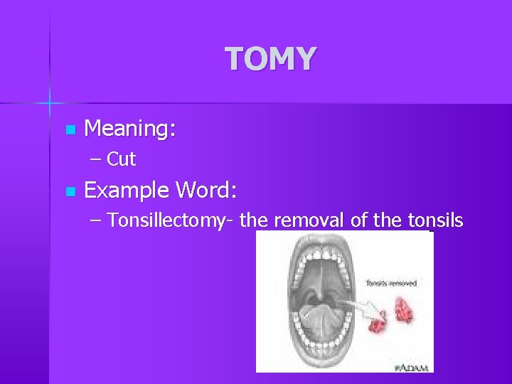 TOMY n Meaning: – Cut n Example Word: – Tonsillectomy- the removal of the TOMY n Meaning: – Cut n Example Word: – Tonsillectomy- the removal of the
