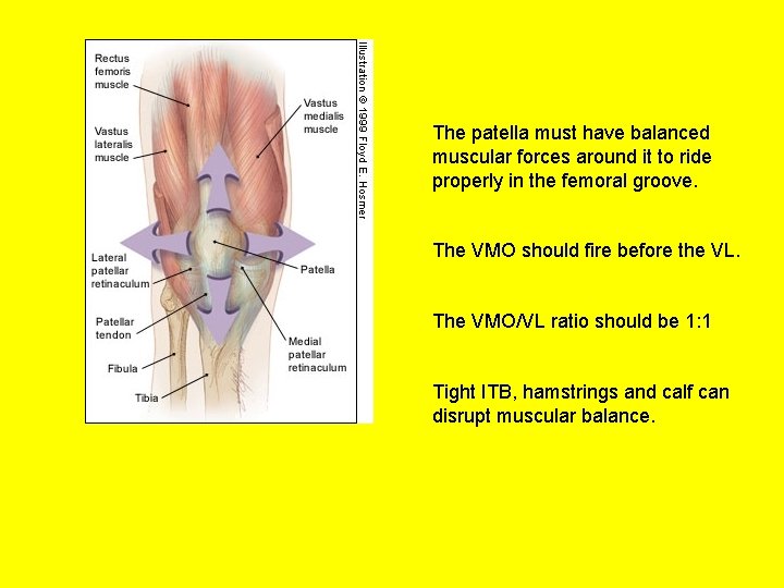 The patella must have balanced muscular forces around it to ride properly in the