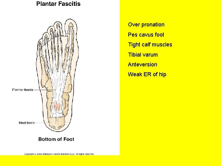 Over pronation Pes cavus foot Tight calf muscles Tibial varum Anteversion Weak ER of