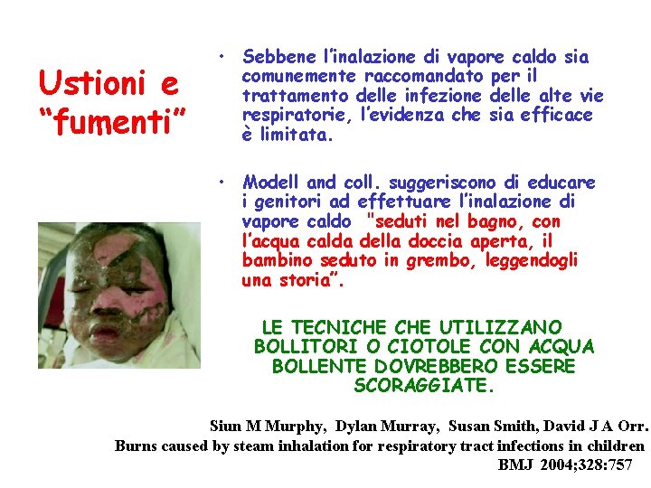 Ustioni e “fumenti” • Sebbene l’inalazione di vapore caldo sia comunemente raccomandato per il