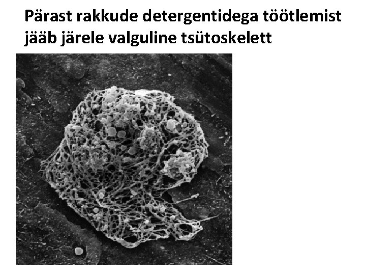 Pärast rakkude detergentidega töötlemist jääb järele valguline tsütoskelett 