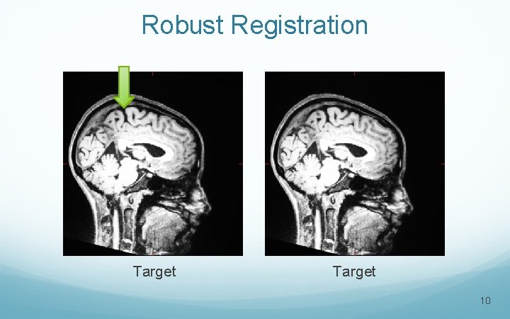 Robust Registration Target 10 