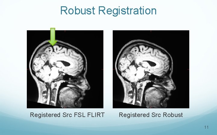 Robust Registration Registered Src FSL FLIRT Registered Src Robust 11 