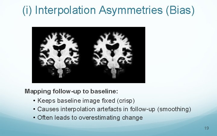 (i) Interpolation Asymmetries (Bias) Mapping follow-up to baseline: • Keeps baseline image fixed (crisp)