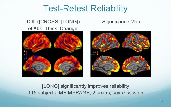 Test-Retest Reliability Diff. ([CROSS]-[LONG]) of Abs. Thick. Change: Significance Map [LONG] significantly improves reliability