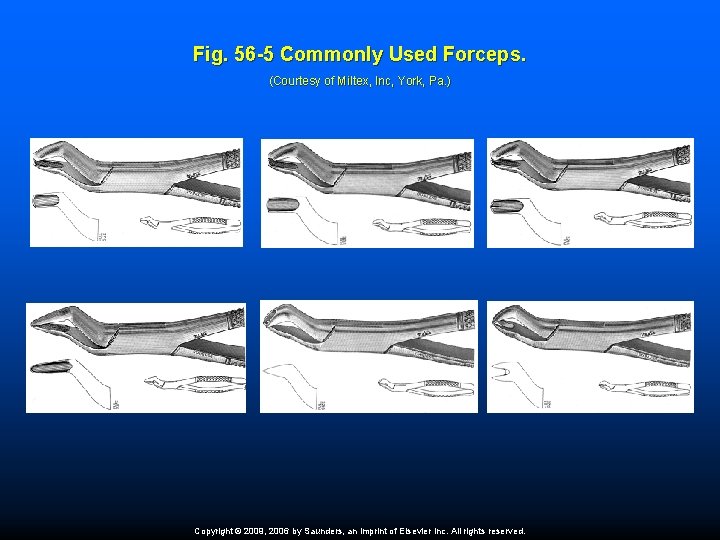 Fig. 56 -5 Commonly Used Forceps. (Courtesy of Miltex, Inc, York, Pa. ) Copyright