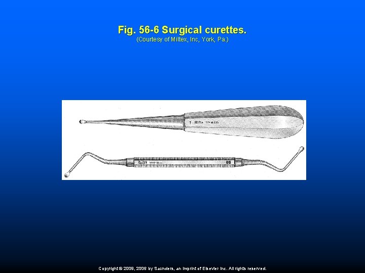 Fig. 56 -6 Surgical curettes. (Courtesy of Miltex, Inc, York, Pa. ) Copyright ©