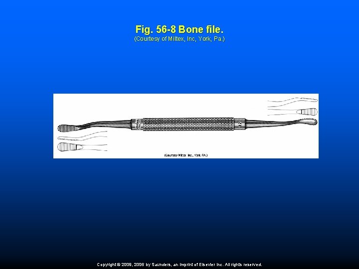 Fig. 56 -8 Bone file. (Courtesy of Miltex, Inc, York, Pa. ) Copyright ©