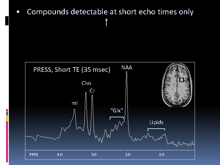  • Compounds detectable at short echo times only PRESS, Short TE (35 msec)