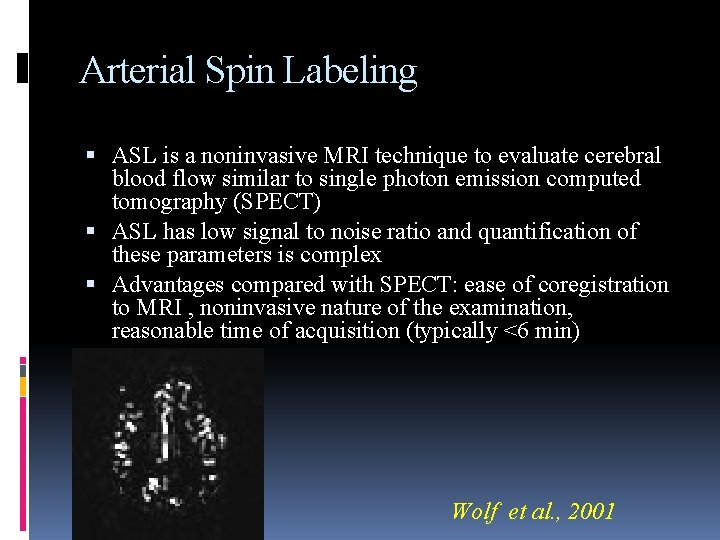 Arterial Spin Labeling ASL is a noninvasive MRI technique to evaluate cerebral blood flow