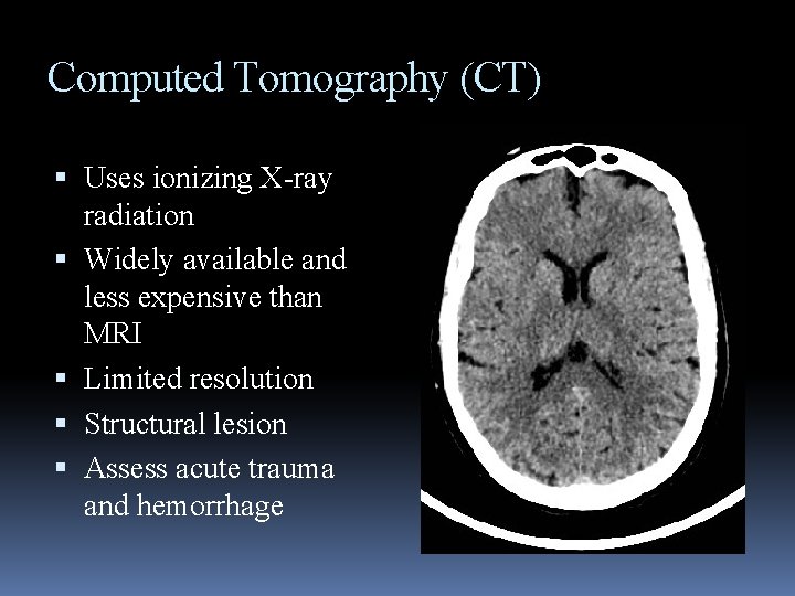 Computed Tomography (CT) Uses ionizing X-ray radiation Widely available and less expensive than MRI