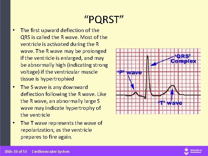 “PQRST” • The first upward deflection of the QRS is called the R wave.