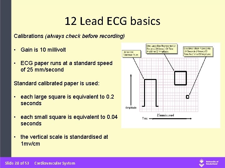 12 Lead ECG basics Calibrations (always check before recording) • Gain is 10 millivolt