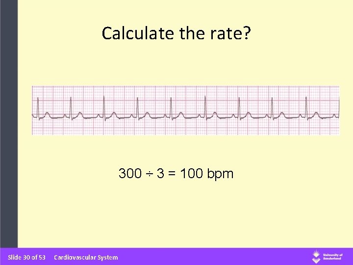 Calculate the rate? 300 ÷ 3 = 100 bpm Slide 30 of 53 Cardiovascular