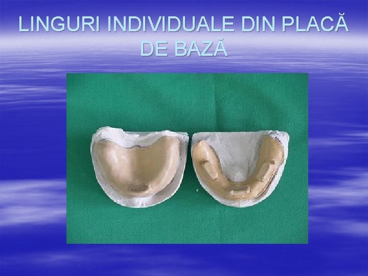 LINGURI INDIVIDUALE DIN PLACĂ DE BAZĂ 