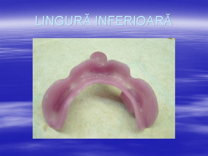 LINGURĂ INFERIOARĂ 