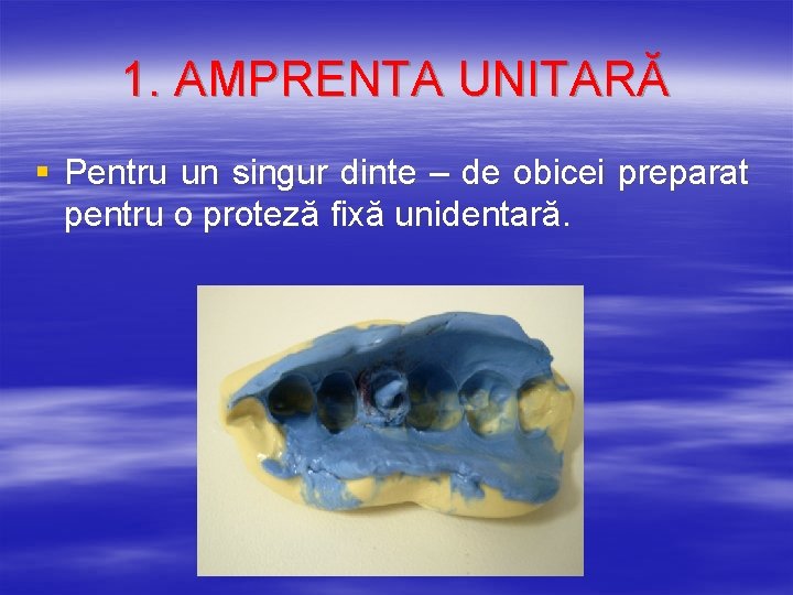 1. AMPRENTA UNITARĂ § Pentru un singur dinte – de obicei preparat pentru o