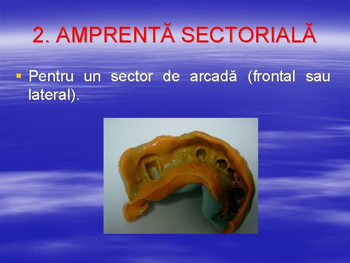 2. AMPRENTĂ SECTORIALĂ § Pentru un sector de arcadă (frontal sau lateral). 