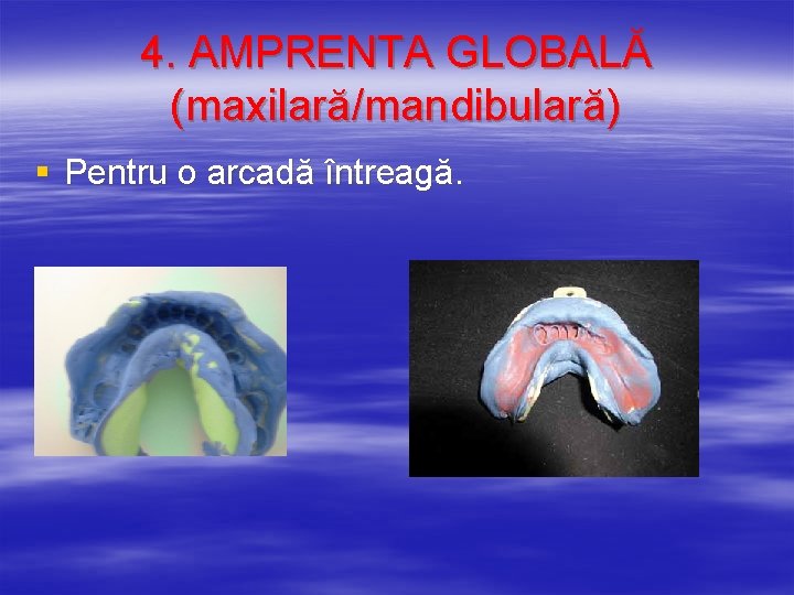 4. AMPRENTA GLOBALĂ (maxilară/mandibulară) § Pentru o arcadă întreagă. 
