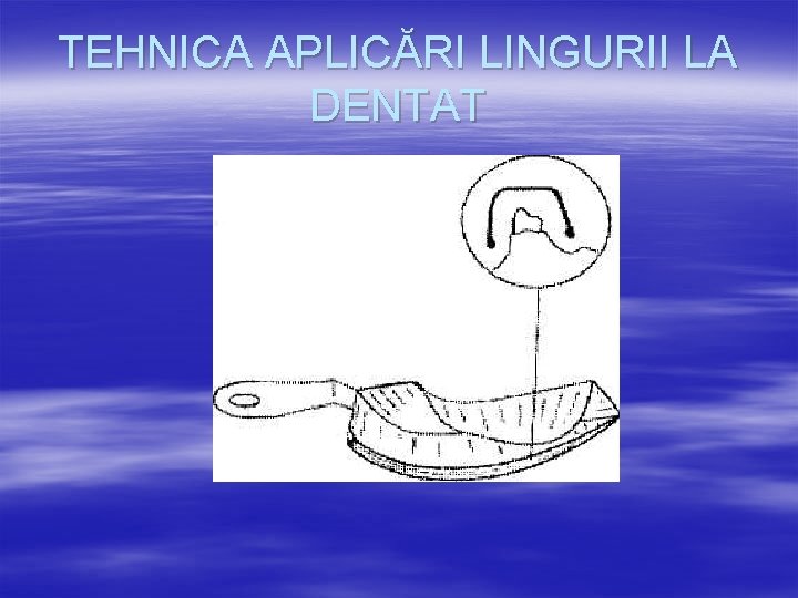 TEHNICA APLICĂRI LINGURII LA DENTAT 