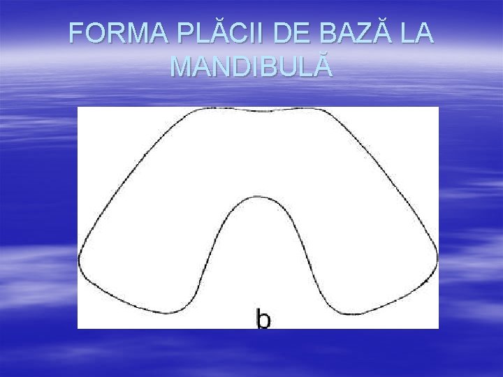FORMA PLĂCII DE BAZĂ LA MANDIBULĂ 