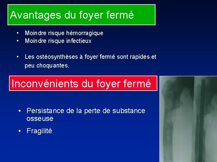 Avantages du foyer fermé • Moindre risque hémorragique • Moindre risque infectieux • Les