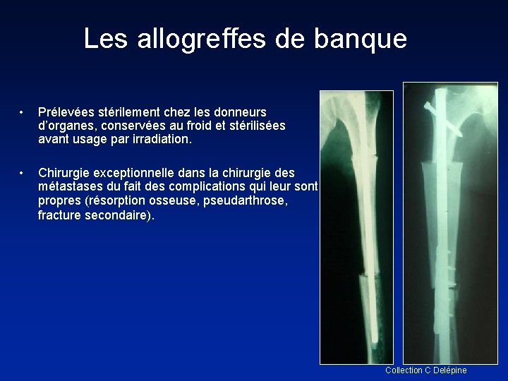 Les allogreffes de banque • Prélevées stérilement chez les donneurs d’organes, conservées au froid