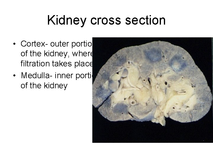 Kidney cross section • Cortex- outer portion of the kidney, where filtration takes place